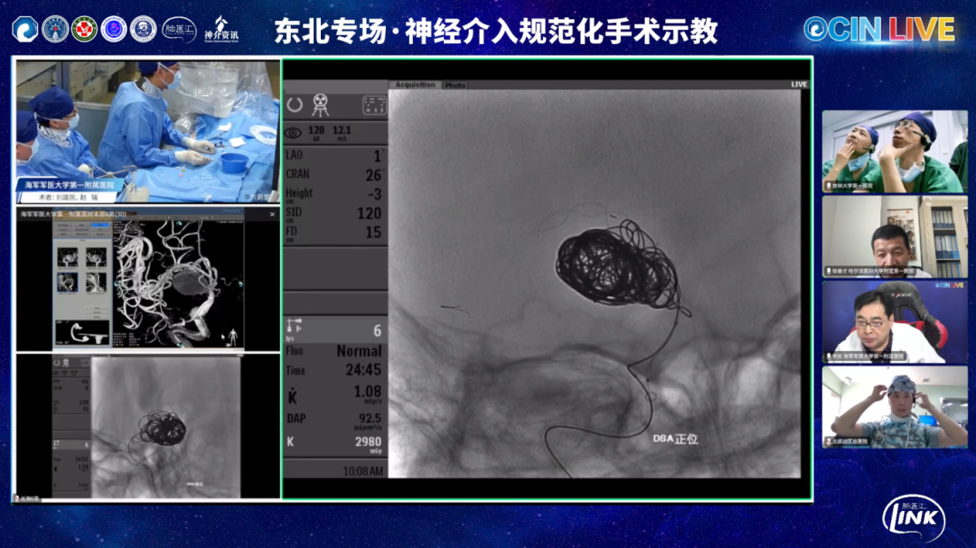 什么是靶向洗脱支架拯救大脑 神通有道｜微创脑科学™助力OCIN LIVE东北专场·神经介入规范化手术示教-上海聚慕医疗器械有限公司