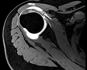 磁共振矩阵怎么计算【市一桐庐医院新设备展示】西门子 Vida 3.0T 磁共振——世界上首台具备生命矩阵系统的磁共振系统_https://www.jmylbn.com_新闻资讯_第8张
