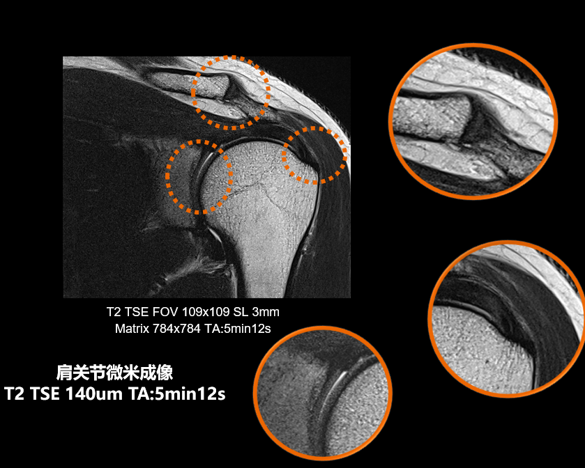 磁共振矩阵怎么计算【市一桐庐医院新设备展示】西门子 Vida 3.0T 磁共振——世界上首台具备生命矩阵系统的磁共振系统_https://www.jmylbn.com_新闻资讯_第7张