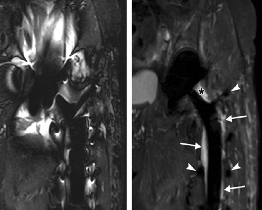 磁共振矩阵怎么计算【市一桐庐医院新设备展示】西门子 Vida 3.0T 磁共振——世界上首台具备生命矩阵系统的磁共振系统_https://www.jmylbn.com_新闻资讯_第9张