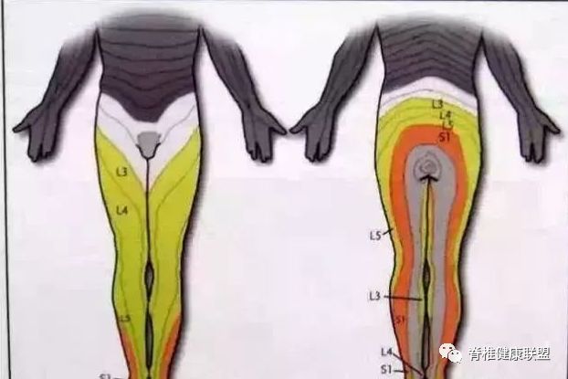 各類型腰腿痛診斷流程 健康 第3張