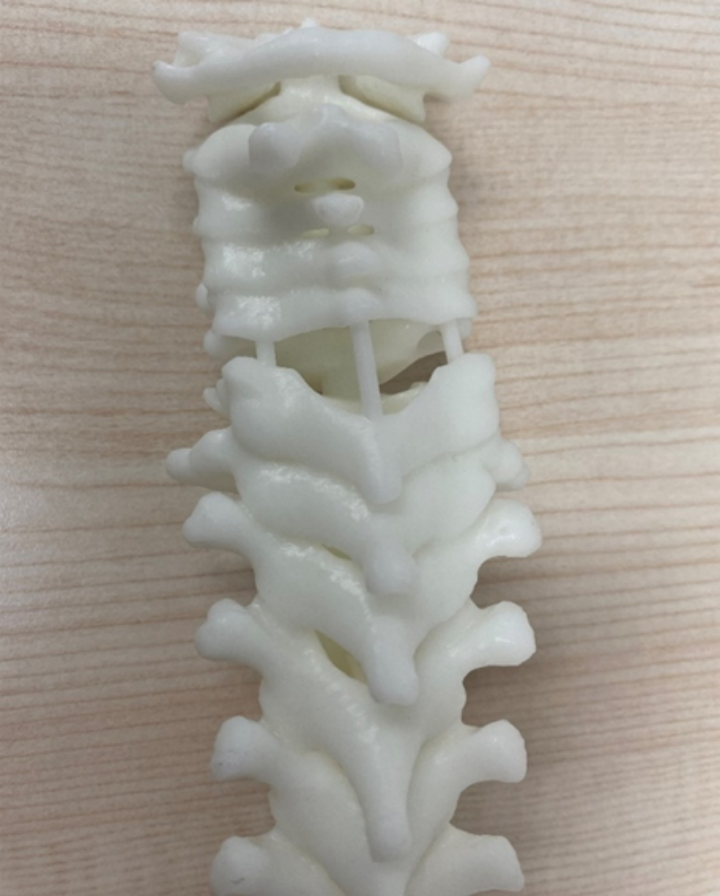 手术耗材是什么急诊患者随时可能截瘫，手术却没有现成耗材，怎么做？_https://www.jmylbn.com_新闻资讯_第5张