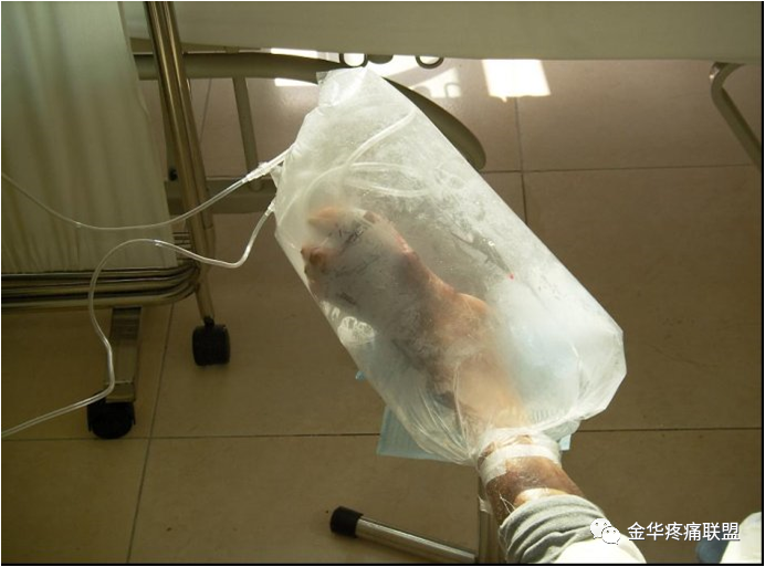 医用臭氧有什么作用医用臭氧仪的作用_https://www.jmylbn.com_新闻资讯_第3张