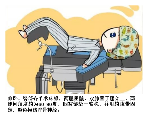 什么是手术无影灯无影灯下的手术体位_https://www.jmylbn.com_新闻资讯_第7张