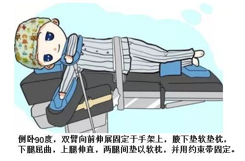什么是手术无影灯无影灯下的手术体位_https://www.jmylbn.com_新闻资讯_第5张