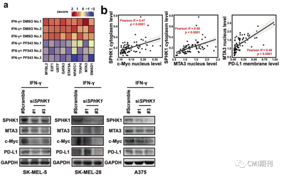 sp管在医学上什么管湘雅医学院刘洪教授在CMI发文，发现SPHK1-MTA3-PD-L1信号轴促进肿瘤免疫逃逸_https://www.jmylbn.com_新闻资讯_第4张
