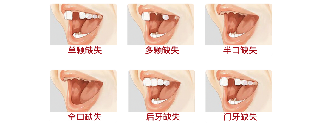数字牙片机怎么用​【博海科室推荐】口腔 · 种植正畸数字化中心，升级改造  正式启用_https://www.jmylbn.com_新闻资讯_第7张