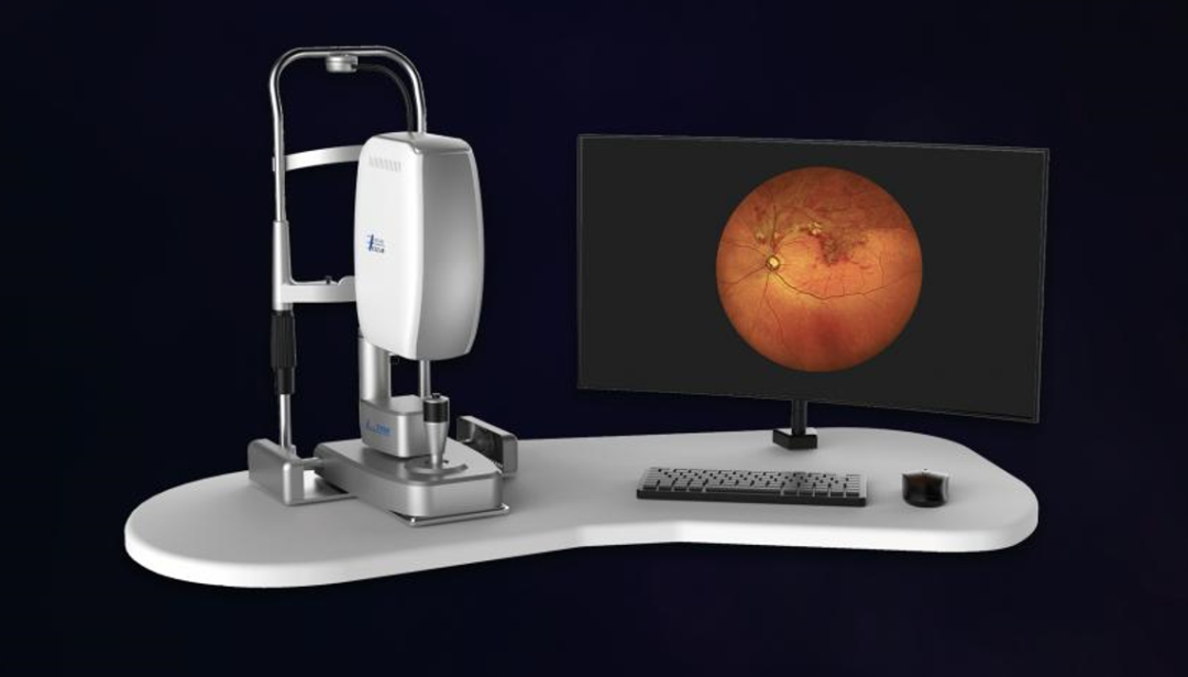 眼底照相能检查出什么免散瞳、快成像！三台县人民医院引进我县首台超广角眼底照相机_https://www.jmylbn.com_新闻资讯_第2张