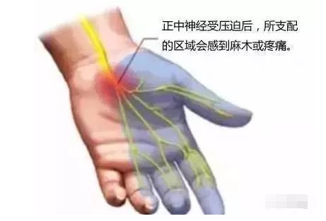 古法经络|手指发麻不只是因为颈椎病，忽略可能致命~