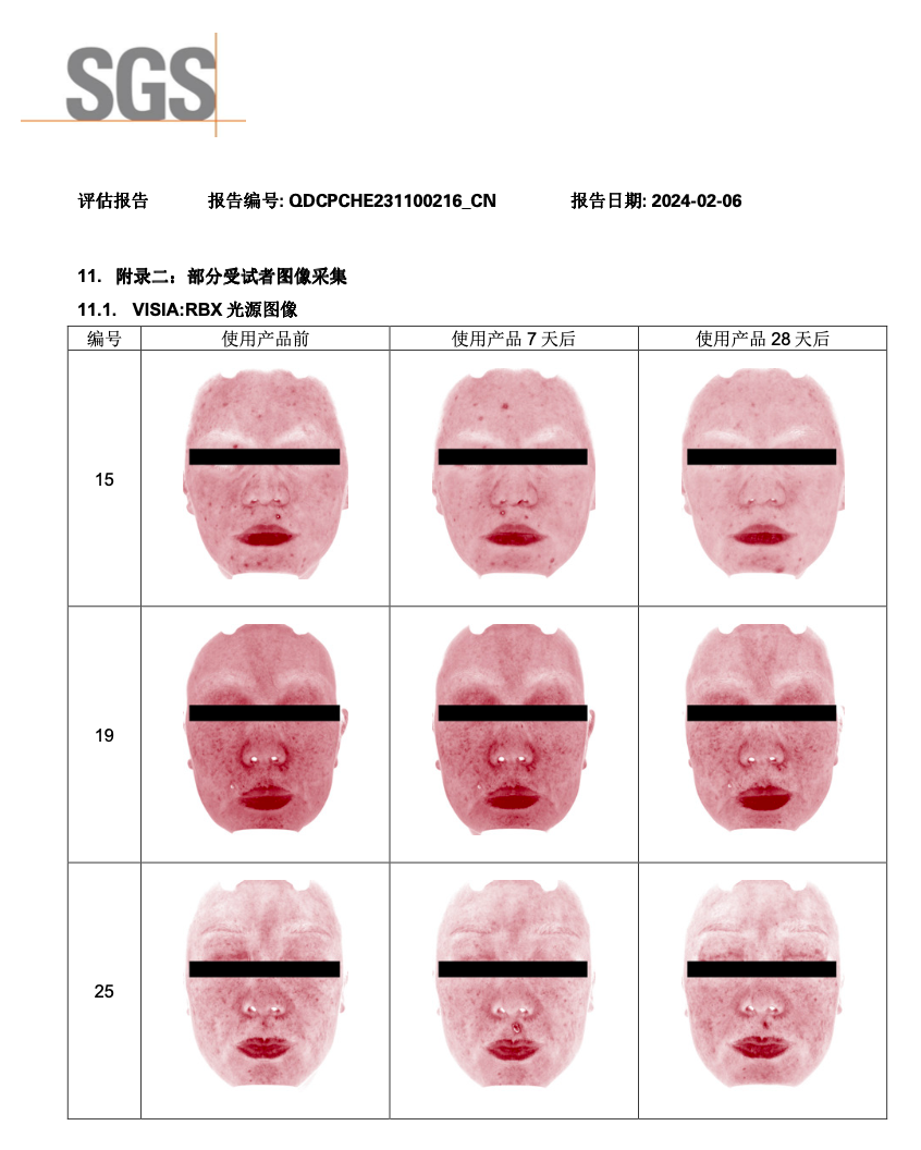 绽媄娅的产品怎么样哪有什么“断崖式衰老”，卷医美不如做好这件事_https://www.jmylbn.com_新闻资讯_第40张