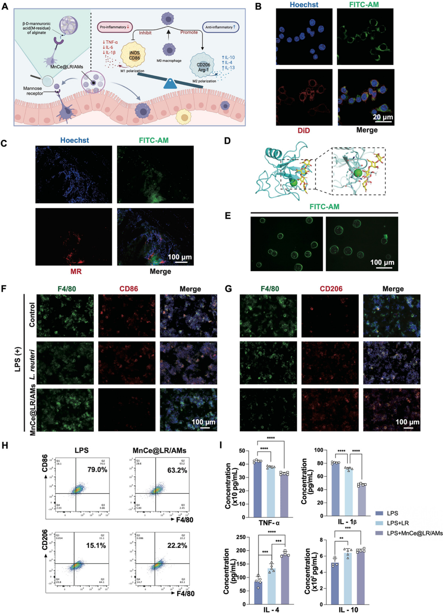 靶向Mn@CeO?納米酶修飾的益生菌水凝膠微球重塑炎癥性腸病中的腸道穩態