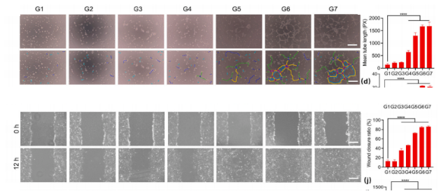 IF12.5 一区：抗菌+促血管生成：壳聚糖水凝胶为糖尿病足治疗注入新希望