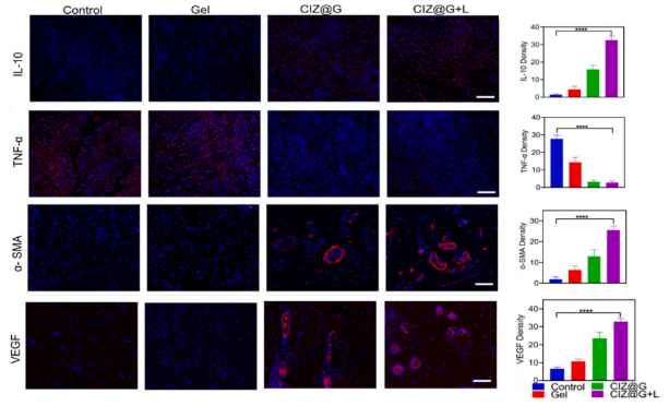 IF12.5 一区：抗菌+促血管生成：壳聚糖水凝胶为糖尿病足治疗注入新希望
