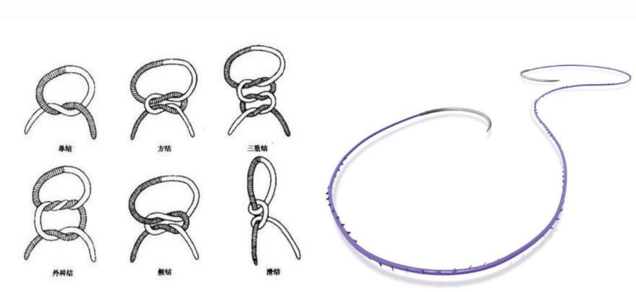 合成外缝线为什么贵缝线那些事 ｜ 你真的了解医用缝线吗？_https://www.jmylbn.com_新闻资讯_第6张