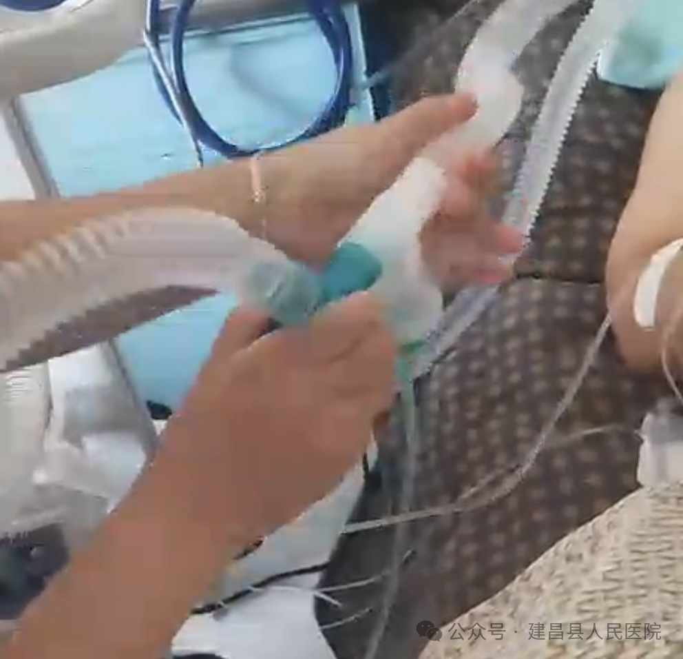 什么病情用呼吸机呼吸机应用中的护理_https://www.jmylbn.com_新闻资讯_第6张