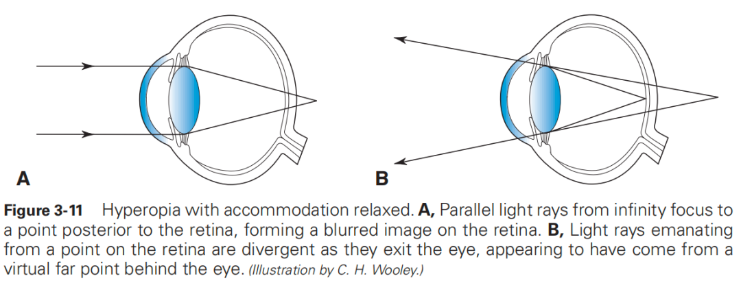什么是对比敏感度【AI教科书】125期：人眼光学——对比敏感度和对比敏感度函数、眼的屈光状态、双眼视_https://www.jmylbn.com_新闻资讯_第6张
