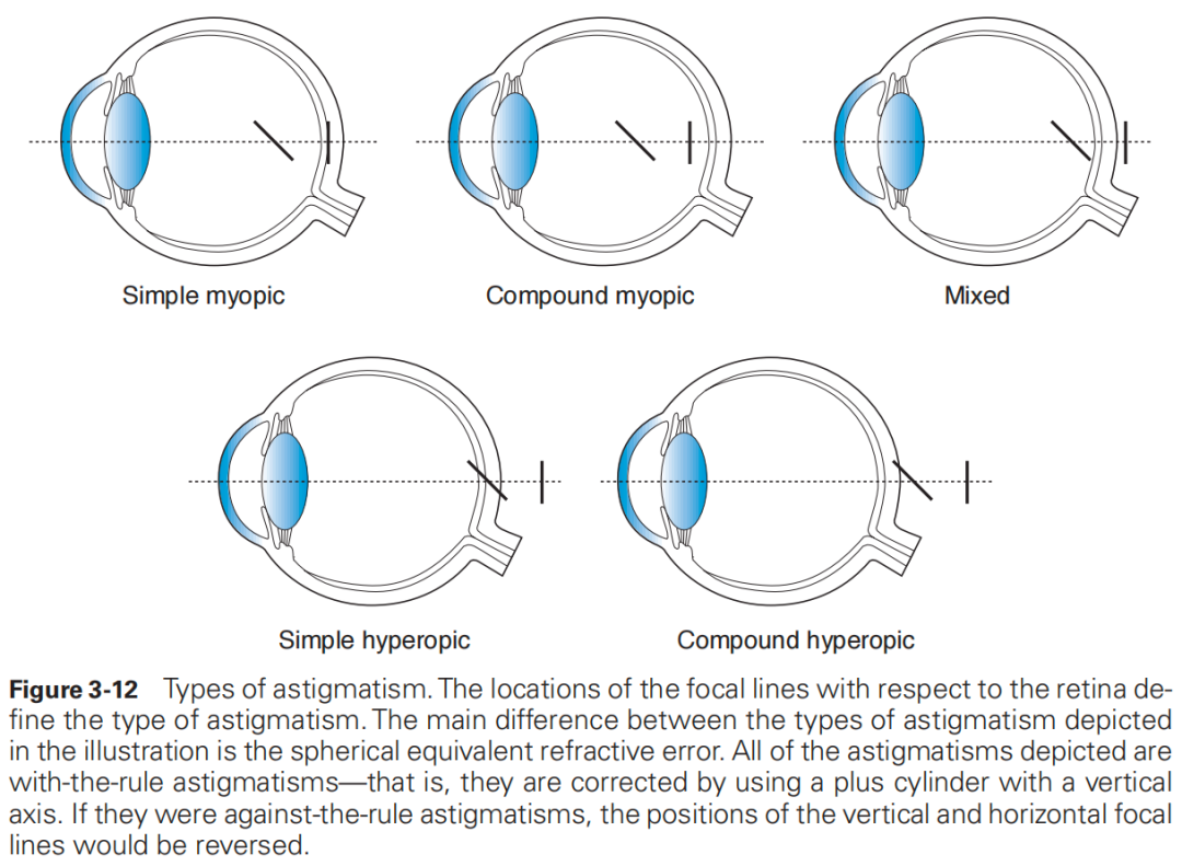 什么是对比敏感度【AI教科书】125期：人眼光学——对比敏感度和对比敏感度函数、眼的屈光状态、双眼视_https://www.jmylbn.com_新闻资讯_第7张
