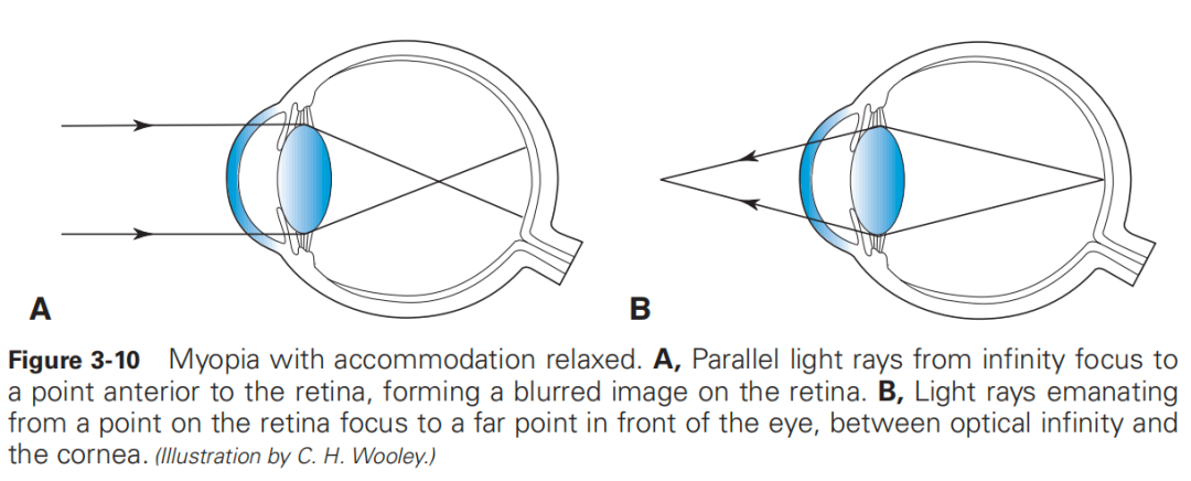 什么是对比敏感度【AI教科书】125期：人眼光学——对比敏感度和对比敏感度函数、眼的屈光状态、双眼视_https://www.jmylbn.com_新闻资讯_第5张