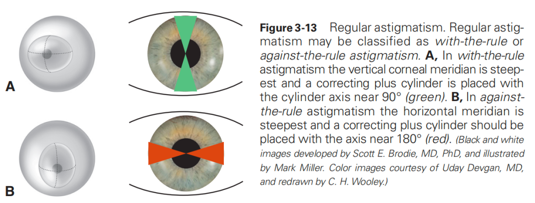 什么是对比敏感度【AI教科书】125期：人眼光学——对比敏感度和对比敏感度函数、眼的屈光状态、双眼视_https://www.jmylbn.com_新闻资讯_第8张