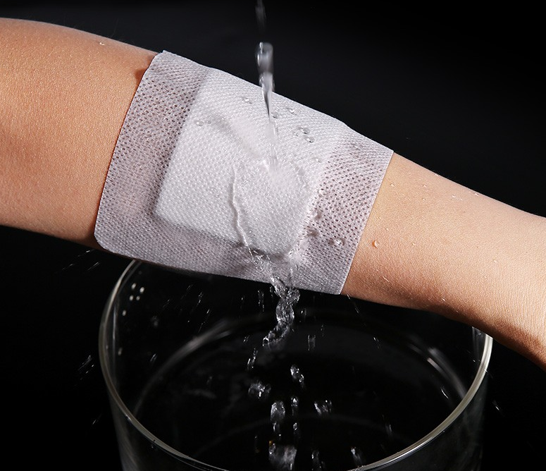 无菌敷料怎么用这个大号“创可贴”，你会用吗？_https://www.jmylbn.com_新闻资讯_第6张