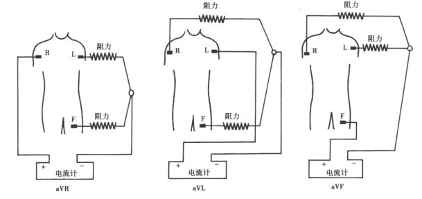 心电图怎么切换导联【干货】肢体导联电极错接的心电图分析及鉴别（上）：四夹子导联_https://www.jmylbn.com_新闻资讯_第4张