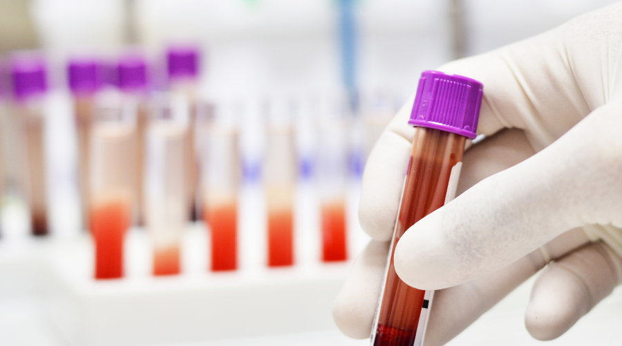 血球厂家有哪些生物医药科技前沿——血液制品系列之企业盘点_https://www.jmylbn.com_新闻资讯_第8张