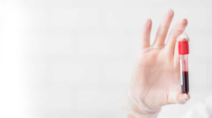 血球厂家有哪些生物医药科技前沿——血液制品系列之企业盘点_https://www.jmylbn.com_新闻资讯_第3张