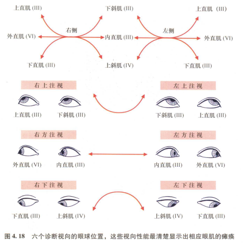 外展枕怎么使用中枢神经系统解剖定位诊断【大全】_https://www.jmylbn.com_新闻资讯_第60张