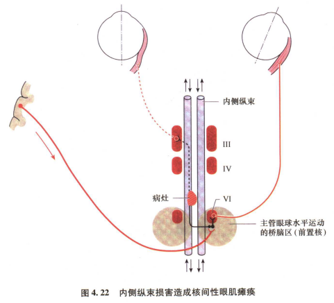 外展枕怎么使用中枢神经系统解剖定位诊断【大全】_https://www.jmylbn.com_新闻资讯_第63张