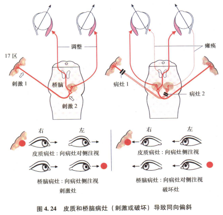 外展枕怎么使用中枢神经系统解剖定位诊断【大全】_https://www.jmylbn.com_新闻资讯_第65张
