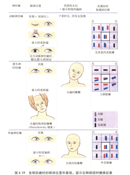 外展枕怎么使用中枢神经系统解剖定位诊断【大全】_https://www.jmylbn.com_新闻资讯_第61张