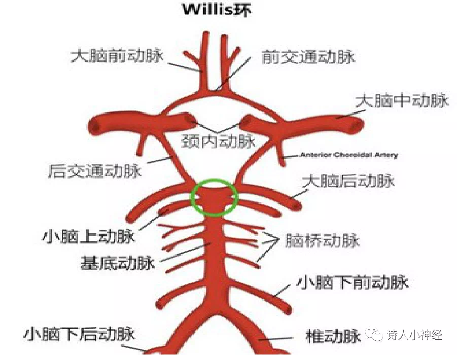 外展枕怎么使用中枢神经系统解剖定位诊断【大全】_https://www.jmylbn.com_新闻资讯_第129张