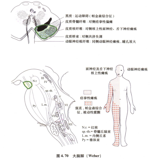 外展枕怎么使用中枢神经系统解剖定位诊断【大全】_https://www.jmylbn.com_新闻资讯_第127张