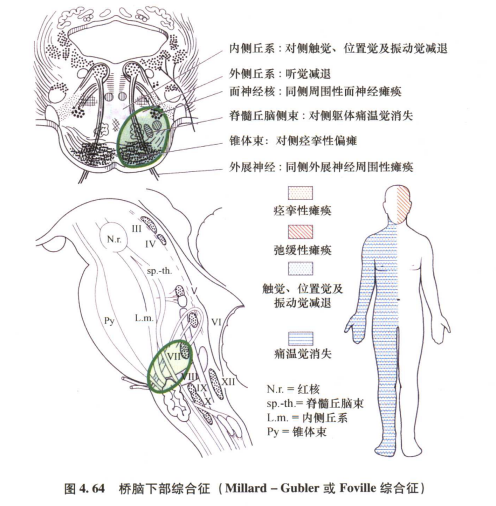 外展枕怎么使用中枢神经系统解剖定位诊断【大全】_https://www.jmylbn.com_新闻资讯_第121张