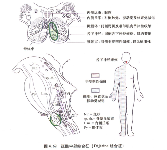 外展枕怎么使用中枢神经系统解剖定位诊断【大全】_https://www.jmylbn.com_新闻资讯_第119张
