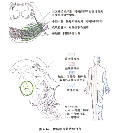 外展枕怎么使用中枢神经系统解剖定位诊断【大全】_https://www.jmylbn.com_新闻资讯_第124张