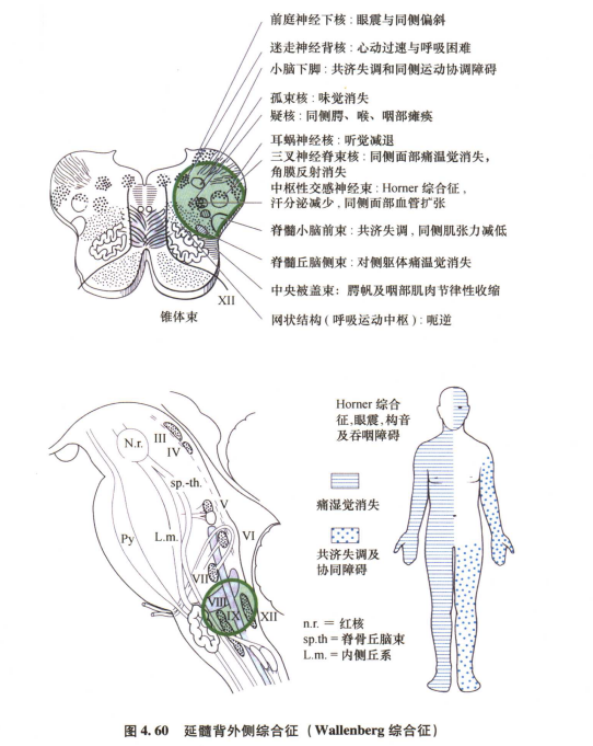 外展枕怎么使用中枢神经系统解剖定位诊断【大全】_https://www.jmylbn.com_新闻资讯_第117张