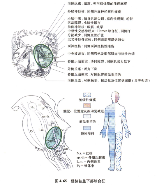 外展枕怎么使用中枢神经系统解剖定位诊断【大全】_https://www.jmylbn.com_新闻资讯_第122张