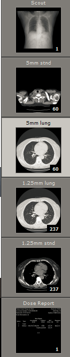 ct打印胶片怎么用远程就医、转院就医时，CT核磁DICOM电子胶片的重要性！【就医知识】_https://www.jmylbn.com_新闻资讯_第4张