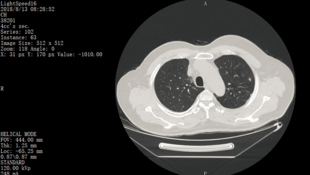 ct打印胶片怎么用远程就医、转院就医时，CT核磁DICOM电子胶片的重要性！【就医知识】_https://www.jmylbn.com_新闻资讯_第1张