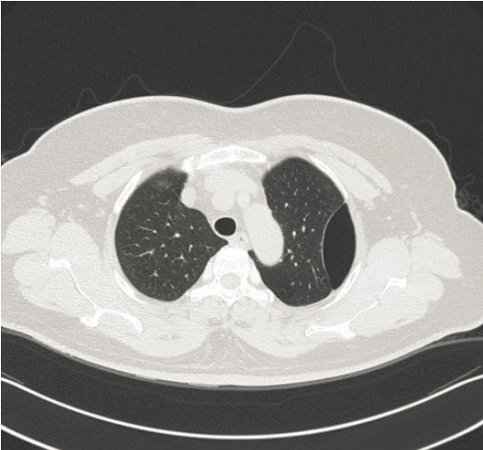 ct打印胶片怎么用远程就医、转院就医时，CT核磁DICOM电子胶片的重要性！【就医知识】_https://www.jmylbn.com_新闻资讯_第2张
