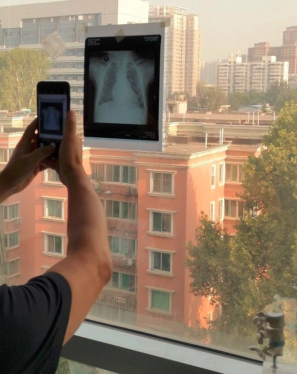 ct打印胶片怎么用远程就医、转院就医时，CT核磁DICOM电子胶片的重要性！【就医知识】_https://www.jmylbn.com_新闻资讯_第7张