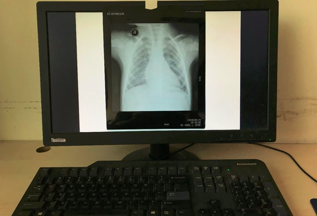 ct打印胶片怎么用远程就医、转院就医时，CT核磁DICOM电子胶片的重要性！【就医知识】_https://www.jmylbn.com_新闻资讯_第6张