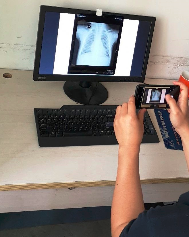 ct打印胶片怎么用远程就医、转院就医时，CT核磁DICOM电子胶片的重要性！【就医知识】_https://www.jmylbn.com_新闻资讯_第8张