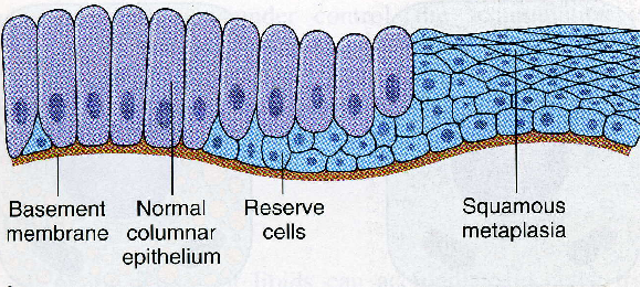 子宫支架怎么上宫颈HPV感染者的福音——宫颈治疗支架疗法，你知多少？（文末获取5分钟速查方式）_https://www.jmylbn.com_新闻资讯_第12张