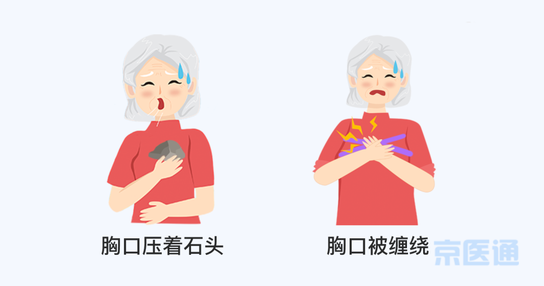 急性心肌梗死如何快速高效急救？