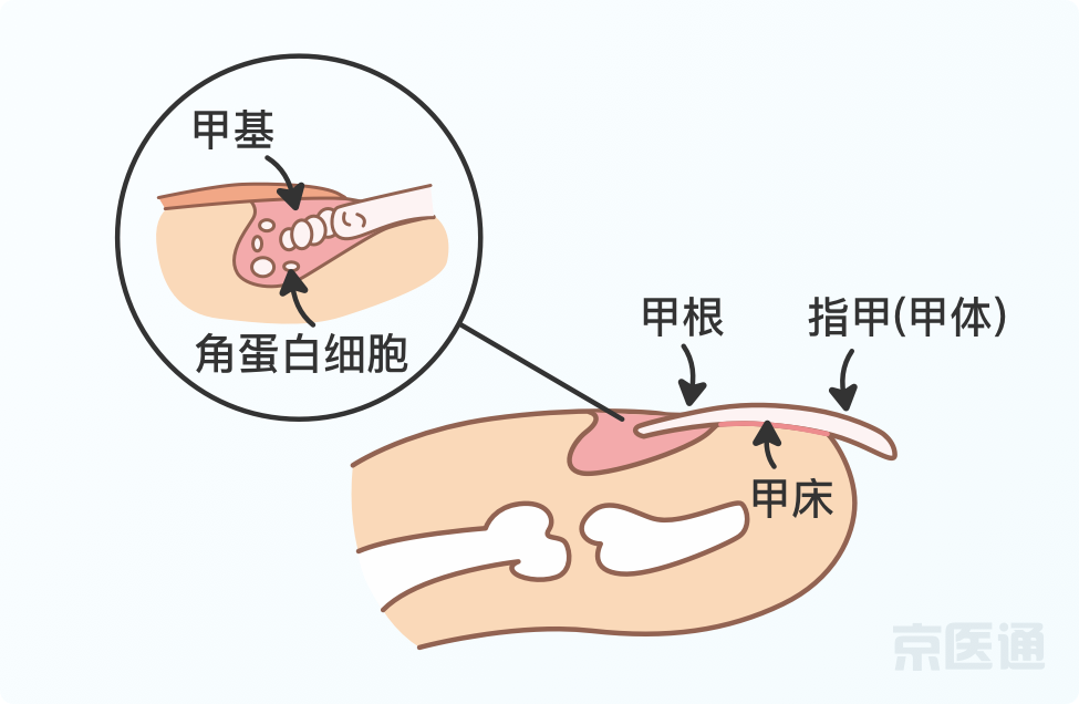 指甲上沒月牙、有橫線、長倒刺，是身體出問題了嗎？ 健康 第4張