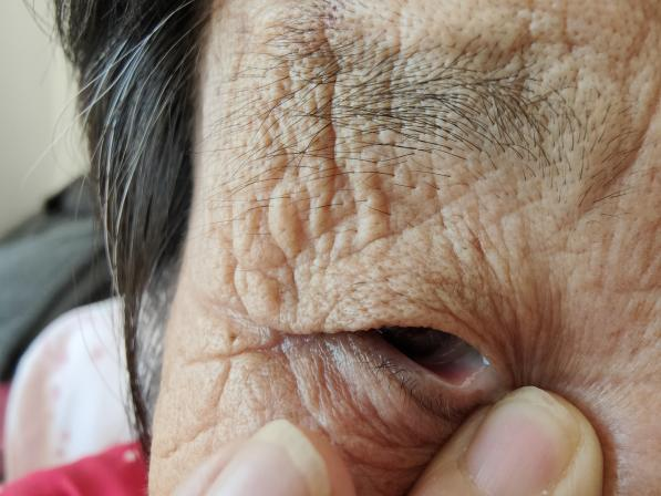 人工鼻怎么使用消炎药=抗生素？原来药没用，这病是靠自己好的_https://www.jmylbn.com_新闻资讯_第5张