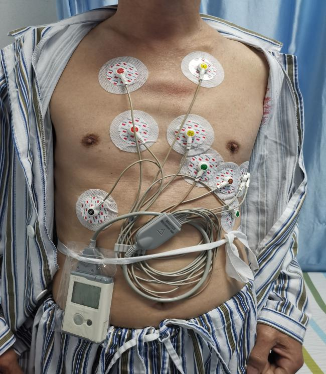 动态心电图机怎么用关＂心＂健康 ｜ 动态心电图机佩戴指引_https://www.jmylbn.com_新闻资讯_第5张