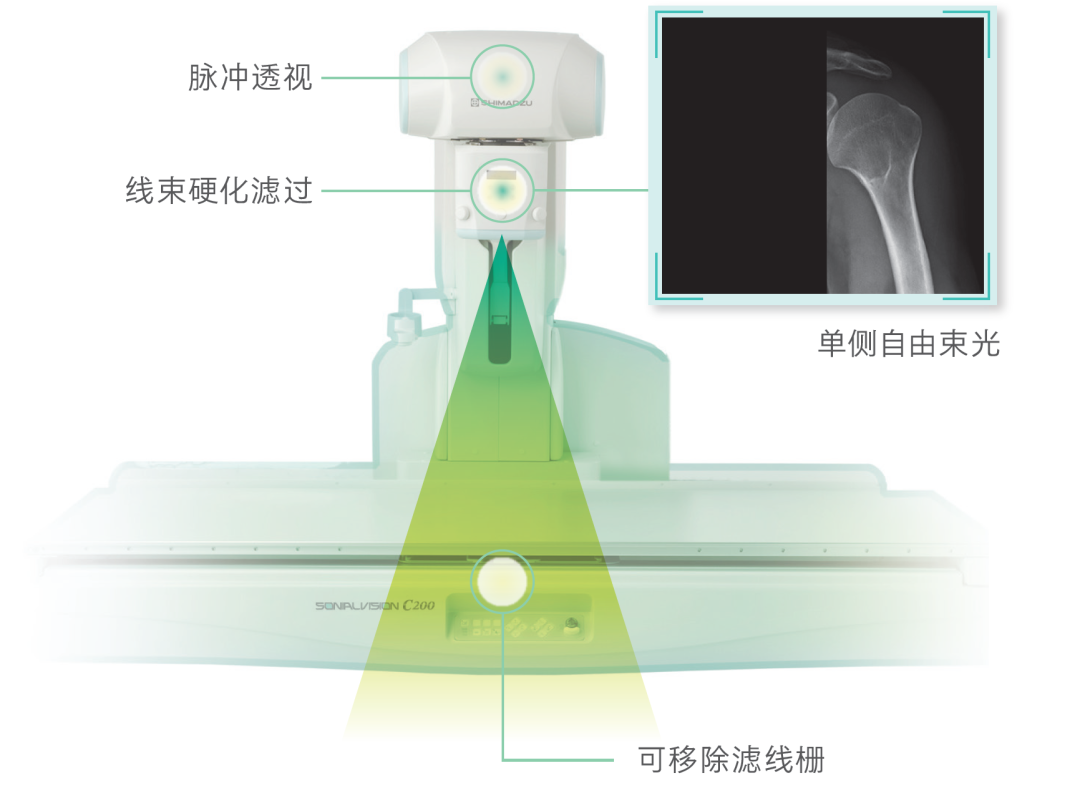 岛津有哪些影像设备【技术推荐】我院医学影像中心引进全新高端多功能设备——岛津C200平板数字多功能X线机_https://www.jmylbn.com_新闻资讯_第4张